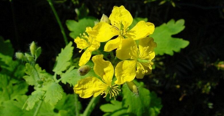 celandine for psoriasis of the hands