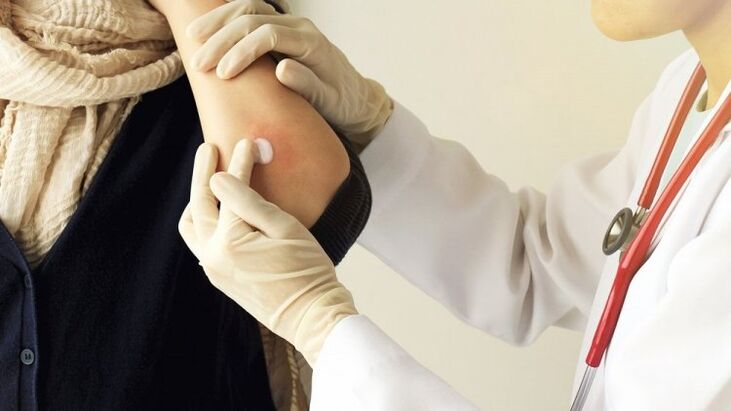 doctor lubricates the elbow for psoriasis